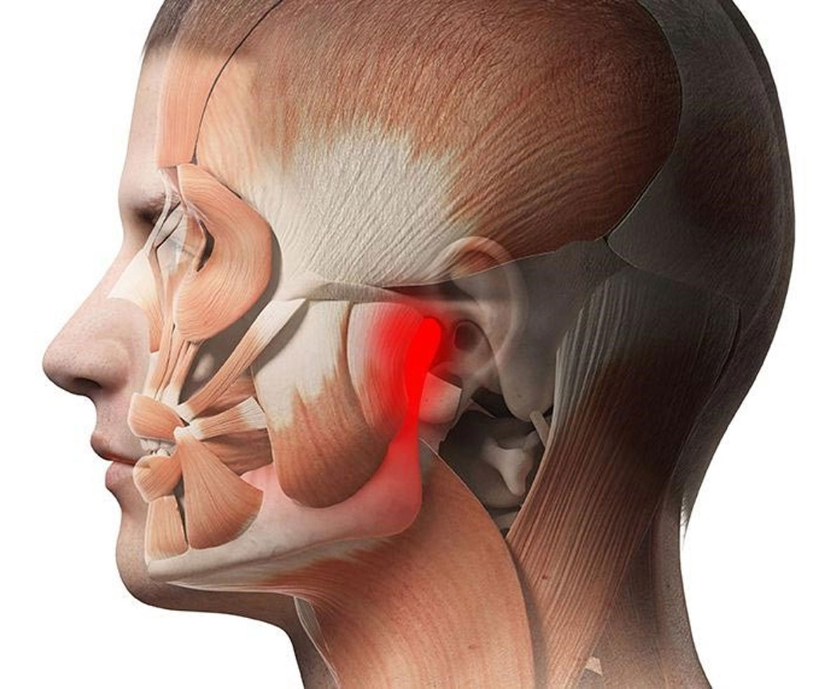 Cirurgia de ATM